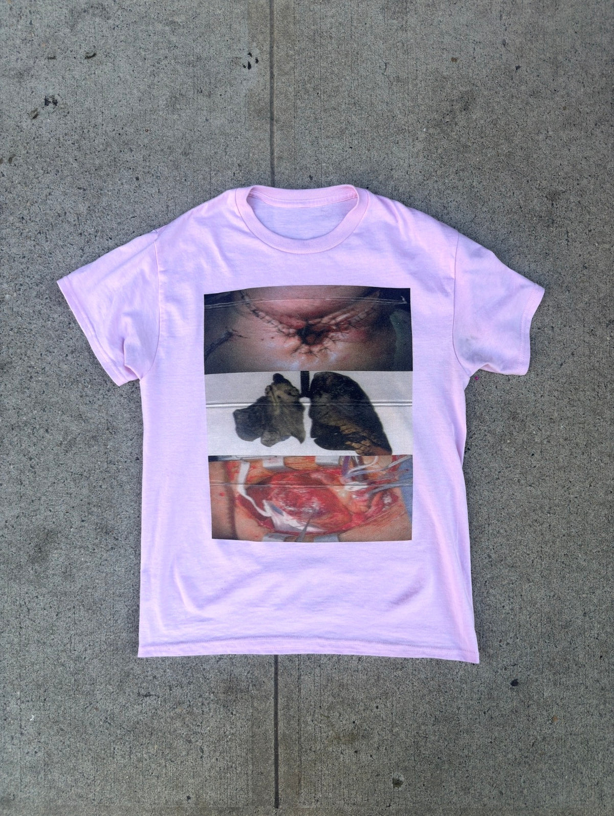 Surgeons Warning Shirt